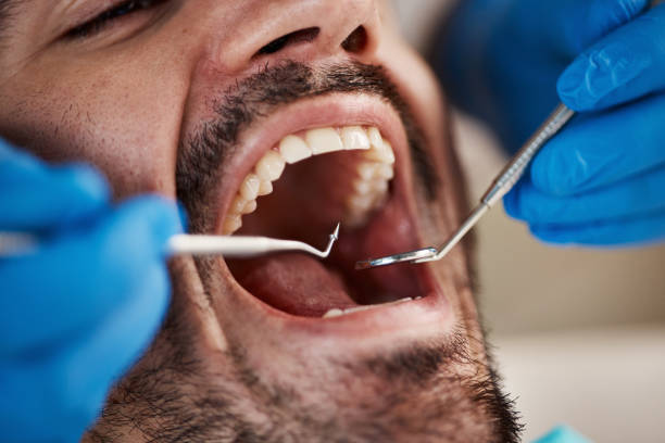 Best Emergency Dental Care for Trauma or Injury in Plum, PA